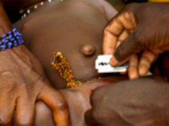 Afrique : pourquoi les Mutilations génitales féminines persistent-elles ?