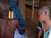 Nigeria: une fillette de 11 ans battue et nourrie de cafards par sa patronne