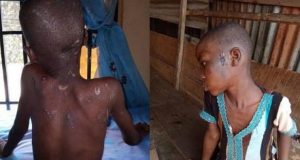 Nigeria: une fillette de 11 ans battue et nourrie de cafards par sa patronne