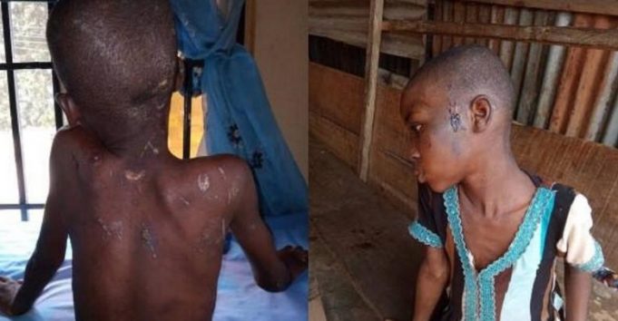 Nigeria: une fillette de 11 ans battue et nourrie de cafards par sa patronne
