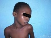 Burkina: une fillette de trois ans décédée suite à un viol
