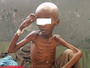 Afrique: « (…) encore une marge de manœuvre pour améliorer la sécurité alimentaire »