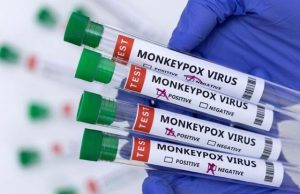 Le variant clade Ib du virus mpox détecté en Chine