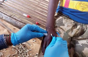 Mpox en Afrique : les enfants particulièrement menacés par la nouvelle variante (OMS/UNICEF)