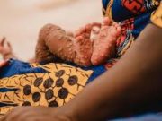 Mpox ou variole du singe: l’Afrique compte ses cas en attendant le vaccin!