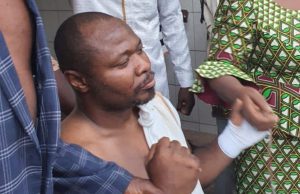 Agression d’un député de la CEDEAO: inacceptable dans un pays de paix comme le Togo