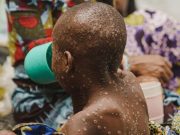 Est de la RDC: l’ONU redoute que les violences alimentent des flambées épidémiques