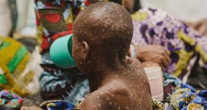 Est de la RDC: l’ONU redoute que les violences alimentent des flambées épidémiques