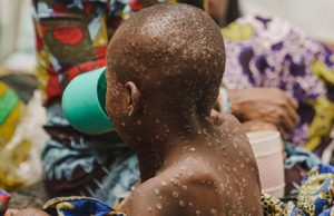 Est de la RDC: l’ONU redoute que les violences alimentent des flambées épidémiques