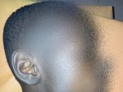 Burkina: un enfant transpercé par une barre de fer