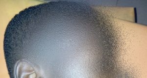 Burkina: un enfant transpercé par une barre de fer