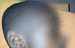 Burkina: un enfant transpercé par une barre de fer
