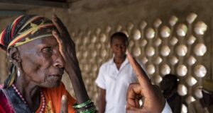 La moitié des personnes atteintes de cataracte attendent une chirurgie salvatrice