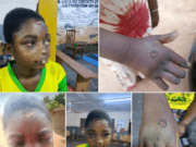 Ouagadougou: un individu interpellé pour maltraitance d’enfant
