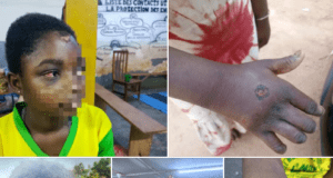 Ouagadougou: un individu interpellé pour maltraitance d’enfant