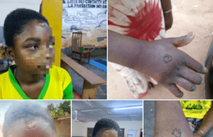 Ouagadougou: un individu interpellé pour maltraitance d’enfant