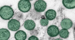 Hantavirus: un cas confirmé en Suisse, la souche des Andes identifiée chez au moins 3 patients