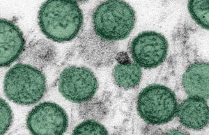 Hantavirus: un cas confirmé en Suisse, la souche des Andes identifiée chez au moins 3 patients