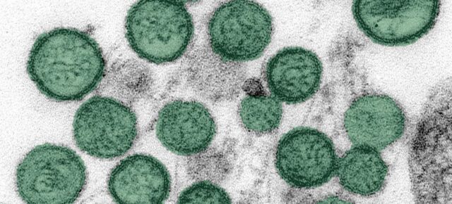 © CDC Une image microscopique améliorée montre le hantavirus.