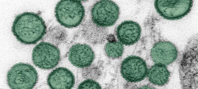 Hantavirus: un cas confirmé en Suisse, la souche des Andes identifiée chez au moins 3 patients