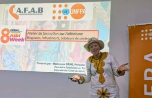 Albinisme: briser les stéréotypes !