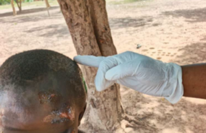 Burkina/Protection de l’enfance: une nouvelle vie commence après la rue