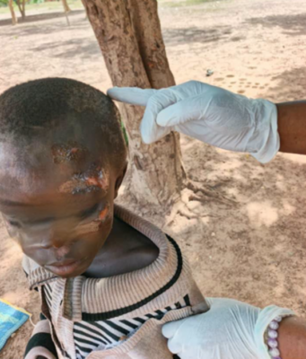 Burkina/Protection de l’enfance: une nouvelle vie commence après la rue